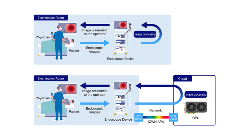 NTT and Olympus Begin World's First Joint Demonstration Experiment of Cloud Endoscopy System