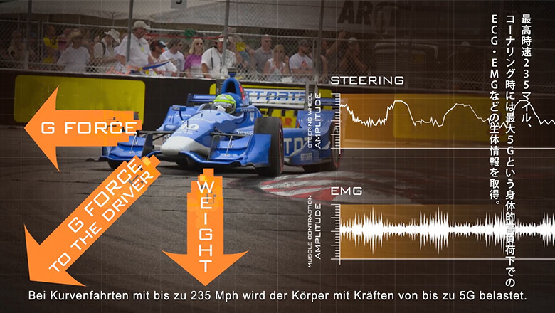 Image: Image of the physical load sustained by racing car drivers