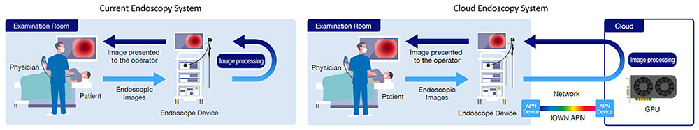 Figure 1 Overview of Cloud Endoscopy System