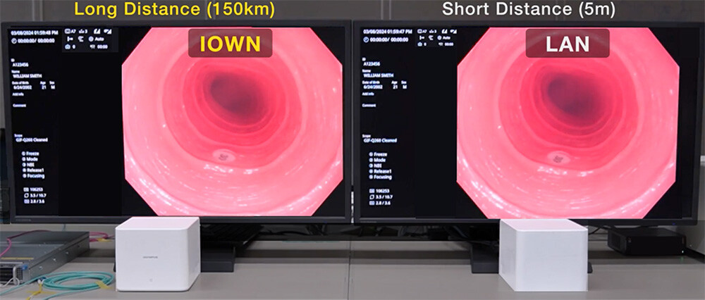 Figure 4 Comparison of the Processed Videos from the APN Configuration and the Local Configuration