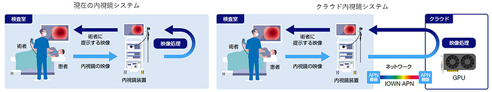 【図1　クラウド内視鏡システムの概要】